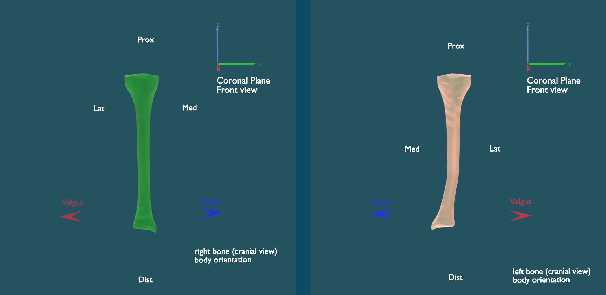 coronal_front0001.png