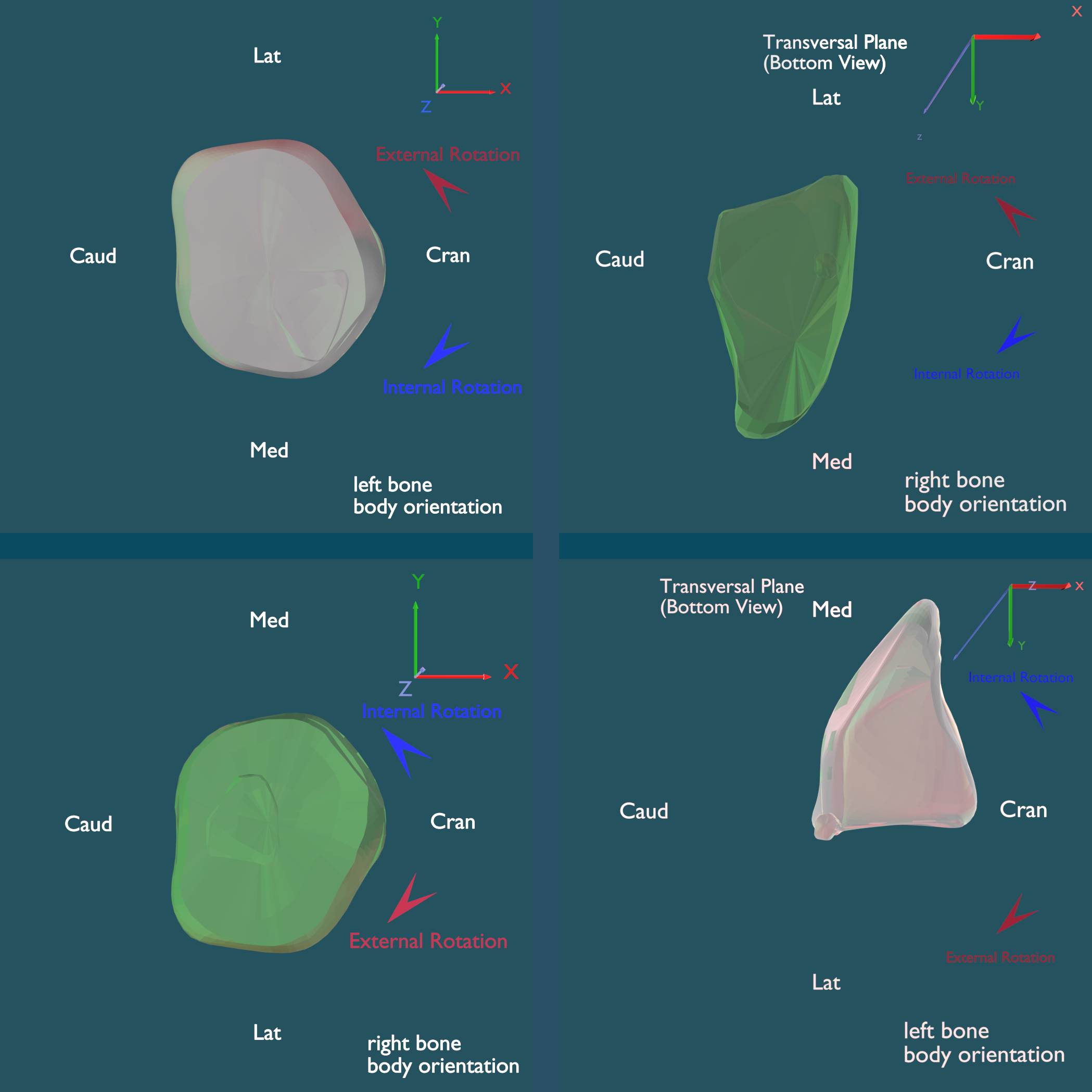 transverse_top_and_bottom_0001.png